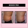 Tighten - Trim - Tone: Body Contouring for women and Men