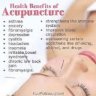 **Acupuncture Treatment Benefit covered**