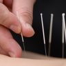 Acupuncture & Massage for immediate Pain relief